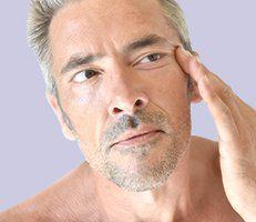 Facelift